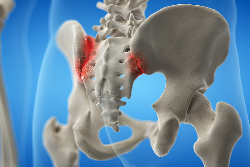 Coccydynia/Coccygeal Pain - The Orthopedic Pain Institute, Beverly Hills  Pain Management Specialist