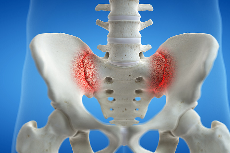 Si Joint Pain Hip Pain At Gary Boatner Blog